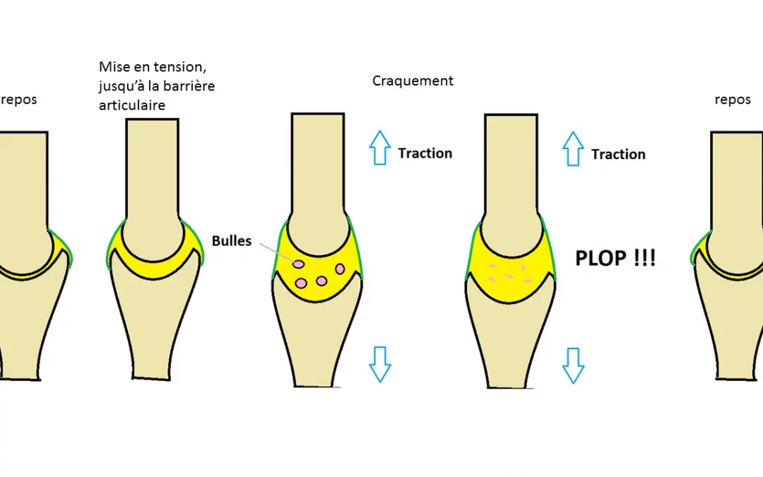 Pourquoi les articulations craquent-elles ? Explication et conseils pour éviter de craquer