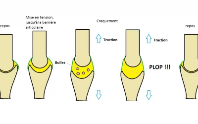 Pourquoi les articulations craquent-elles ? Explication et conseils pour éviter de craquer