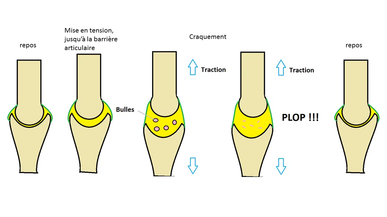 expliquer le craquement articulaire